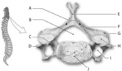   Photo Credit: Ralph T. Hutchings Figure 6-3 A Cervical Vertebra (Superior View)  Use Figure 6-3 to identify the labeled part. -Structure A is the A)  vertebral arch. B)  dens. C)  spinous process. D)  pedicle. E)  lamina.
