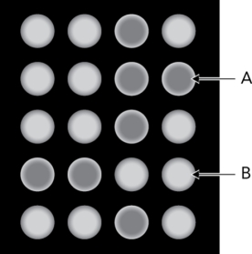 The figure below is a fluorescence readout from a lectin array.What can be deduced from B?   A)  There is no interaction between the glycan and the lectin in the well. B)  There is a glycan-lectin interaction in the well. C)  There is an interaction, but there is no way to determine the species that are interacting. D)  Glycan cleavage from the glycoconjugate has been achieved.