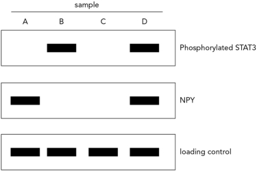 <strong>Neuronal samples from wild-type mice were monitored in the absence and presence of leptin via Western blotting.The data are shown below.Choose the answer that correctly identifies the NPY/AGRP neuronal samples obtained in the absence and then the presence of leptin. </strong> A) B; C B) D; B C) A; C D) C; A
