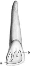 In the following illustration,structure  a  refers to a fossa,which is a convexity or bulge on a tooth.Structure  b  refers to a ridge,which is a concavity or depression within a tooth.   A)  Both statements are true. B)  The first statement is true;the second statement is false. C)  The first statement is false;the second statement is true. D)  Both statement are false.