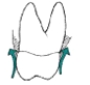 Which illustration depicts an overcontoured restoration? A)    B)    C)   