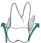 Which illustration depicts an overcontoured restoration? A)    B)    C)   