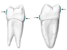 What are the arrows pointing to in the illustration below?   A)  Contact areas B)  Height of curvature C)  Buccal contour D)  Excess curvature E)  None of the above
