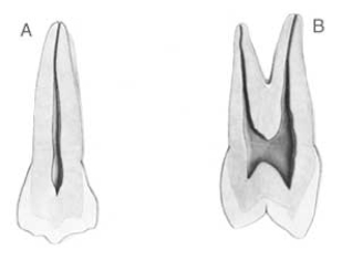 Figure  B  below illustrates a view of which surface?   A)  Buccal B)  Lingual C)  Mesial D)  Distal