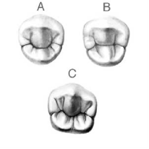 In figure  C  below,identify the tooth,the number of cusps,and groove pattern.   A)  Mandibular second premolar;three cusps; Y  groove pattern B)  Mandibular first premolar;three cusps; H  groove pattern C)  Mandibular first premolar;three cusps; U  groove pattern D)  Mandibular second premolar;two cusps; C  groove pattern