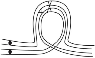 <strong>Inversion heterokaryotypes are often characterized as having reduced crossing over and reduced fertility.Assume that you were examining a strain of organisms you knew to be inversion heterokaryotypes and saw a relatively high number of double chromatid bridges extending between anaphase I nuclei,as indicated in the following drawing.What is the product of this type of inversion loop? </strong> A)two acentric fragments and two dicentric chromosomes B)two chromosomes with deletions and two acentric fragments C)one acentric fragment,one dicentric chromosome,and two wild- type chromosomes D)two chromosomes with deletions and two with duplications E)four wild- type chromosomes
