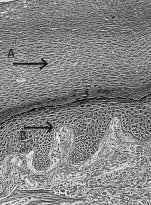 The letter  A  in the above figure represents   A) keratin-filled, dead epithelial cells. B) replicating epithelium. C) mucus produced by underlying ciliated cells. D) white blood cells attacking a bacterial cell. E) all of these.