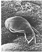 To which of the following groups does the organism in the above figure belong?   A) diplomonads, parabasalids, trypanosomes, and euglenoids B) ciliates, dinoflagellates, and apicomplexans C) water molds, diatoms, and brown algae D) chlorophyte and charophyte algae E) amoebas and slime molds