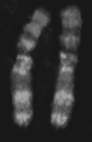 The above figure represents   A) individual genes from an asexual worm. B) maternal chromosomes that are identical. C) paternal chromosomes that are identical. D) both maternal and paternal chromosomes. E) none of these.