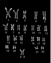 The above figure reveals which of the following about the organism that it was obtained from?   A) male B) female C) human D) mouse E) two of these are correct