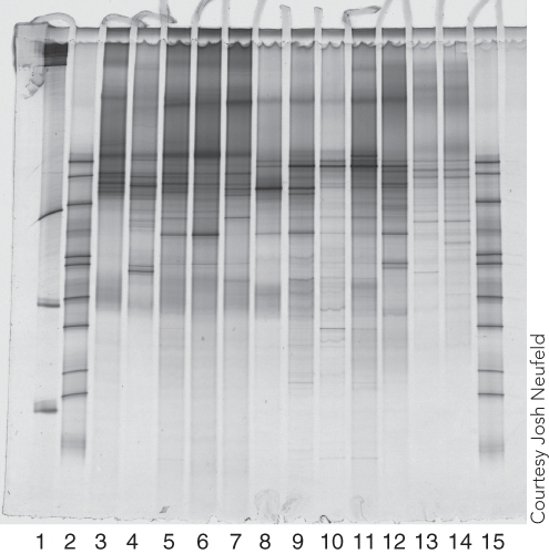 Which two lanes appear to have DNA from the most closely related or identical microbes/populations?   A) Lanes 3 and 4 B) Lanes 4 and 5 C) Lanes 5 and 6 D) Lanes 8 and 9 E) Lanes 12 and 14