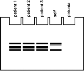 Your friend works at the Centers for Disease Control and Prevention and has discovered a brand-new virus that has recently been introduced into the human population.She has just developed a new assay that allows her to detect the virus by using PCR products made from the blood of infected patients.The assay uses primers in the PCR assay that hybridize to sequences in the viral genome. Your friend is distraught because of the result she obtained (see Figure 10-28)  when she looked at PCR products made using the blood of three patients suffering from the viral disease, using her own blood, and using a leaf from her petunia plant. You advise your friend not to panic, as you believe she is missing an important control.Which one of the choices listed below is the best control for clarifying the results of her assay? Explain your answer.   Figure 10-28 A) a PCR assay using blood from a patient who is newly infected but does not yet show symptoms B) a PCR assay using blood from a dog C) a PCR assay using blood from an uninfected person D) repeating the experiments she has already done with a new tube of polymerase
