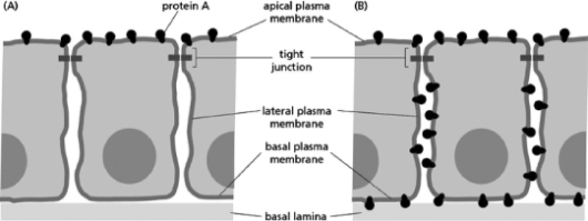 Consider the apical location of a particular protein expressed in epithelial cells, illustrated in part A of Figure 11-35.Which type of defect described below is the most likely to cause the redistribution of that protein around the entire cell, shown in part B of Figure 11-35   Figure 11-35 A) a nonfunctional protein glycosylase B) the deletion of a junctional protein C) the truncation of a protein found in the extracellular matrix D) a nonfunctional flippase