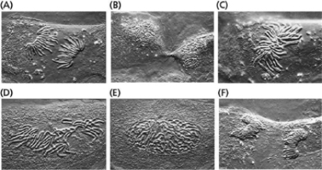 Figure 18-10 shows a living cell from the lung epithelium of a newt at different stages in M phase.Order these light micrographs into the correct sequence and identify the stage in M phase that each represents.    Figure 18-10