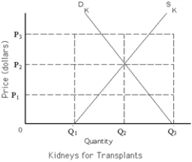 Exhibit 4-5    -Refer to Exhibit 4-5. Suppose the government imposes a price ceiling at P = $0 for transplanted kidneys. The result will be a A) shortage of kidneys equal to (Q<sub>3</sub> - Q<sub>1</sub>) . B) surplus of kidneys equal to (Q<sub>3</sub> - Q<sub>1</sub>) . C) shortage of kidneys equal to (Q<sub>2</sub> - Q<sub>1</sub>) . D) surplus of kidneys equal to (Q<sub>2</sub> - Q<sub>1</sub>) .