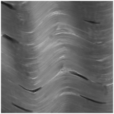   -The tissue shown in the photograph forms:   A) bone. B) skeletal muscle. C) nerves. D) ligaments. E) smooth muscle.