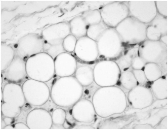   -The tissue in the photograph is an example of ________ tissue.   A) connective B) muscle C) nerve D) epithelial