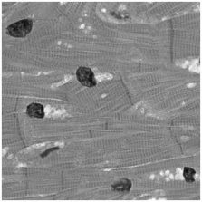   -This tissue is:   A) adipose tissue. B) cardiac muscle. C) nerve tissue. D) simple epithelium. E) smooth muscle.