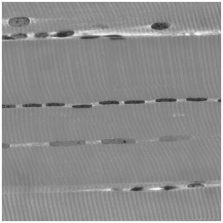   -The tissue in the photograph is:   A) skeletal muscle. B) connective tissue. C) nerve tissue. D) stratified epithelium. E) simple epithelium.