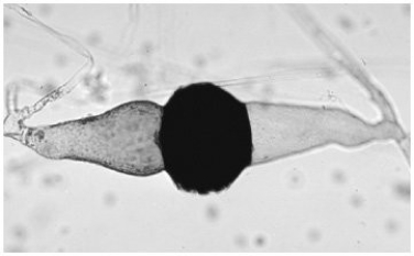 The structure in the photograph is a(n) :   A) seed. B) zygosporangium. C) ascus. D) glomeromycetes. E) basidium.