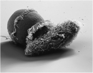 The organisms in the photo are:   A) rhizarians. B) alveolates. C) stramenopiles. D) excavates. E) euglenozoans.