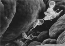 What characteristic do the organisms in the photos share?     A) Both are photosynthetic. B) Both are parasites. C) Both use pseudopods to capture food. D) Both have calcium carbonate shells. E) Both are multicellular.