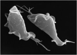 What characteristic do the organisms in the photos share?     A) Both are photosynthetic. B) Both are parasites. C) Both use pseudopods to capture food. D) Both have calcium carbonate shells. E) Both are multicellular.