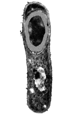 The bacterium in the figure contains a(n) :   A) virus. B) nucleus. C) endospore. D) biofilm. E) prion.
