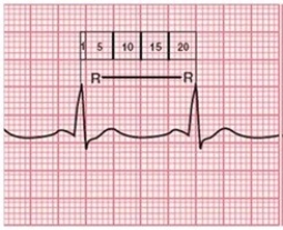 Which method of calculating the heart rate is shown below?   A) 1500 method B) R-R method C) 6-second method D) 1-minute method
