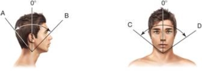   -The type of movement shown by letter C in the picture is ____. A)  flexion B)  hyperextension C)  right lateral flexion D)  left lateral flexion E)  external rotation