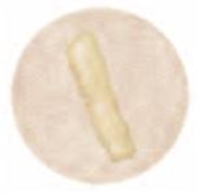The microscopic cast found in urine and pictured here is a(n) ________ cast.  