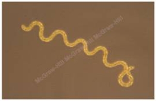 The spiral-shaped bacterium pictured here is classified as a ____. A) bacillus B) coccus C) spirillum D) vibrio E) parasite