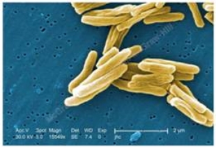 The bacteria pictured here are classified as ____.   A)  bacilli B)  spirilla C)  cocci D)  vibrios E)  parasites