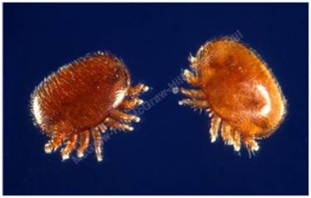 The parasitic insect pictured here burrows under the skin and causes ____.   A)  Rocky Mountain Spotted Fever B)  scabies C)  malaria D)  plague E)  trichinosis