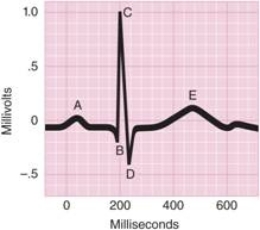   -The letters BCD designate the ________ complex, which indicates that an electrical impulse was sent through the ventricles.