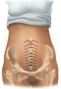 The home care nurse is assessing the level of a mother's fundus who delivered 3 days ago. Where should the fundus be located?   A)  A B)  B C)  C D)  D
