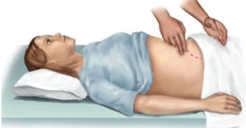 The nurse performs the following while assessing a postpartum patient. For what is the nurse assessing?   A)  Fundal height B)  Uterine bleeding C)  Bladder distention D)  Abdominal distention