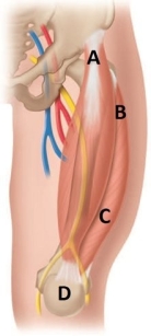 <strong>The nurse is preparing to provide a newborn with a prescribed intramuscular injection. Which area should the nurse use for this injection? </strong> A) A B) B C) C D) D
