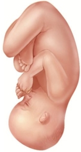A laboring patient is attempting a vaginal birth. An episiotomy has already been performed and the healthcare provider is prepared to extend the episiotomy if necessary. What is this fetus's most likely presentation? A)    B)    C)    D)   