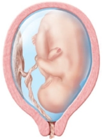 During an intrapartum vaginal examination the following is assessed. In which position should the patient be placed at this time?   A)  Supine B)  Side-lying C)  Lithotomy D)  Knee-chest