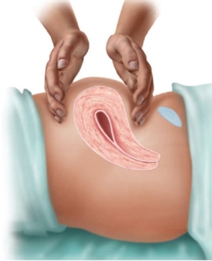 The nurse is observed performing the following with a patient:   What information will this assessment technique provide to the nurse? A)  Assesses for bladder distention B)  Estimates the weight of the uterus C)  Determines the height of the fundus D)  Evaluates the remaining placenta contents