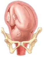 <strong>During an intrapartum vaginal examination the nurse palpates the following:   Based upon this information, which diagram best describes the fetal descent and station? </strong> A)   B)   C)   D)   <div style=padding-top: 35px> 