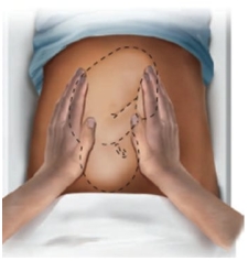 <strong>The nurse is performing Leopold maneuvers with a patient in the 3rd trimester of pregnancy. Which maneuver should the nurse perform first?</strong> A) B) C) D)