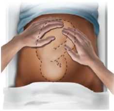 <strong>The nurse is performing Leopold maneuvers with a patient in the 3rd trimester of pregnancy. Which maneuver should the nurse perform first?</strong> A) B) C) D)