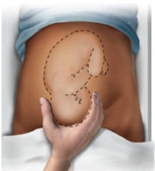 <strong>The nurse is performing Leopold maneuvers with a patient in the 3rd trimester of pregnancy. Which maneuver should the nurse perform first?</strong> A) B) C) D)