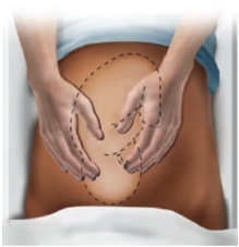 <strong>The nurse is performing Leopold maneuvers with a patient in the 3rd trimester of pregnancy. Which maneuver should the nurse perform first?</strong> A) B) C) D)