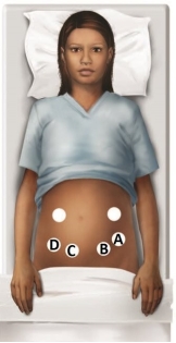 The fetus of a pregnant patient is in the right occiput anterior (R O A)  position. Where should the nurse auscultate the fetal heart sounds?   A)  A B)  B C)  C D)  D