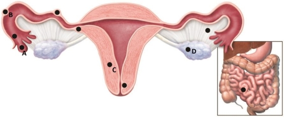 The maternity nurse is preparing material for a staff development seminar on ectopic pregnancy. When using the diagram below, which area should the nurse identify as being the most common location for the implantation of an ectopic pregnancy?   A)  A B)  B C)  C D)  D