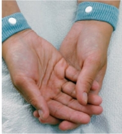 During a routine health visit the nurse notes that a patient who is 10 weeks pregnant is wearing the following items. On what should the nurse focus when assessing the patient?   A)  Heartburn B)  Constipation C)  Hemorrhoids D)  Nausea and vomiting