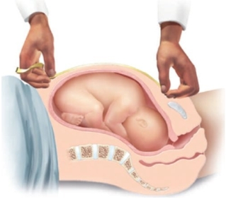 The nurse is measuring the fundal height of a patient who is at 28 weeks' gestation using the following method. What would be considered a normal finding?   A)  22 c m B)  24 c m C)  28 c m D)  30 c m
